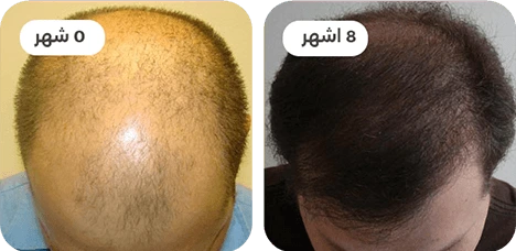 ba-1.webp