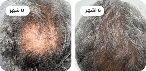 ba-3.webp