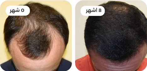ba.webp