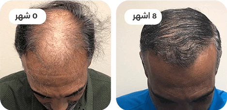 ba2.webp