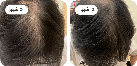 ba5_.webp